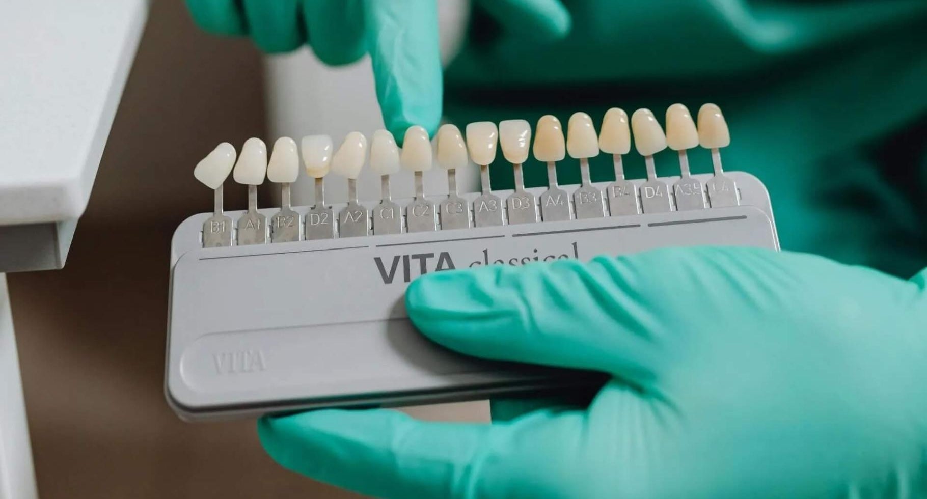 No-Prep Veneers in Huntington Beach