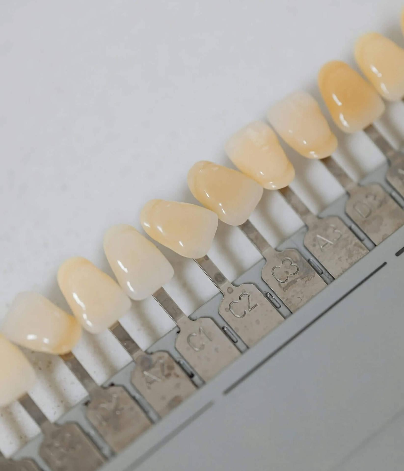 Porcelain Veneers in Huntington Beach